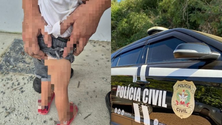 Mãe é presa por torturar menina de 3 anos e expor bebê nua nas redes sociais em SC: ‘filmou tudo’