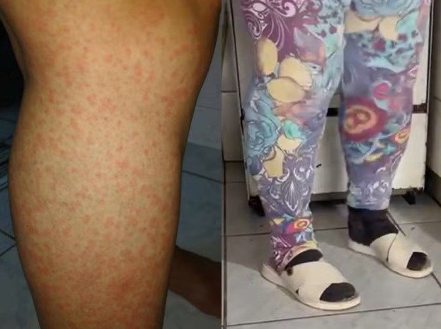 ‘Portas fechadas a 34°C’: moradores vivem reféns de infestação de maruins em SC