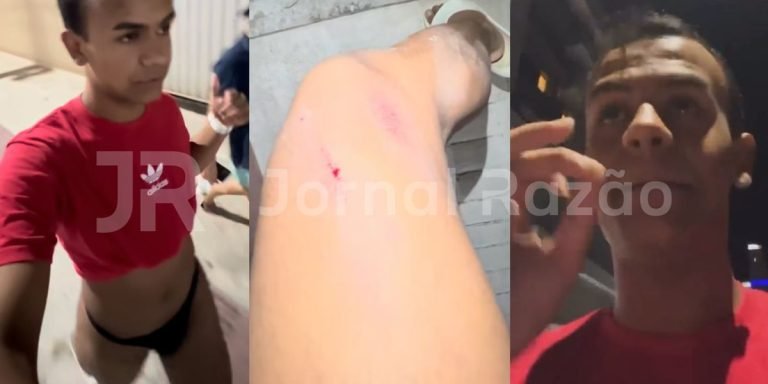 Jovem diz ter sido vítima de homofobia em Balneário Camboriú: “jogou o pitbull pra me morder”